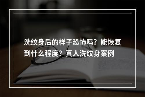 洗纹身后的样子恐怖吗？能恢复到什么程度？真人洗纹身案例