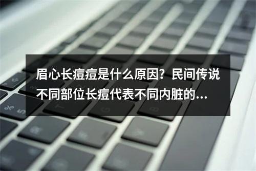 眉心长痘痘是什么原因？民间传说不同部位长痘代表不同内脏的问题？