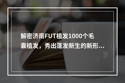 解密济南FUT植发1000个毛囊植发，秀出蓬发新生的新形象