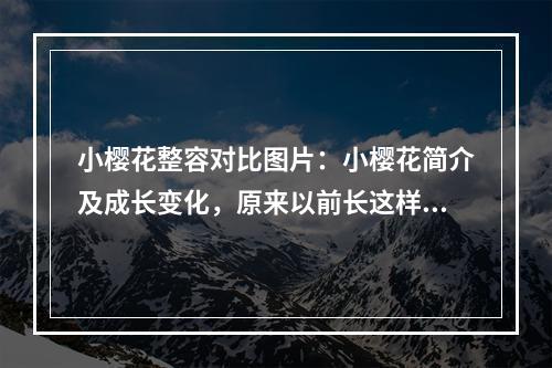 小樱花整容对比图片：小樱花简介及成长变化，原来以前长这样子…