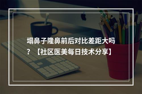 塌鼻子隆鼻前后对比差距大吗？【社区医美每日技术分享】