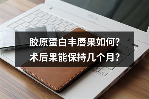 胶原蛋白丰唇果如何？术后果能保持几个月？