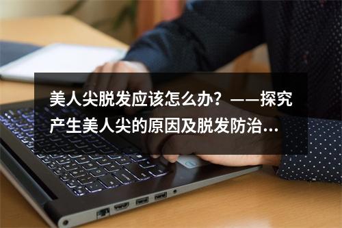 美人尖脱发应该怎么办？——探究产生美人尖的原因及脱发防治方法