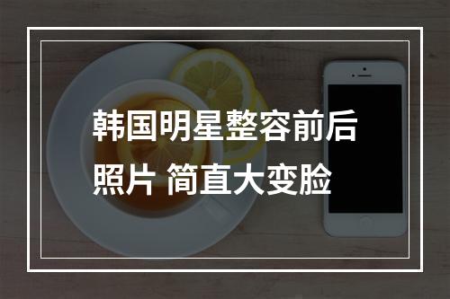 韩国明星整容前后照片 简直大变脸