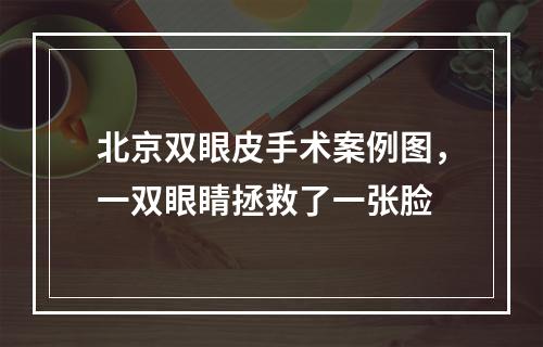 北京双眼皮手术案例图，一双眼睛拯救了一张脸