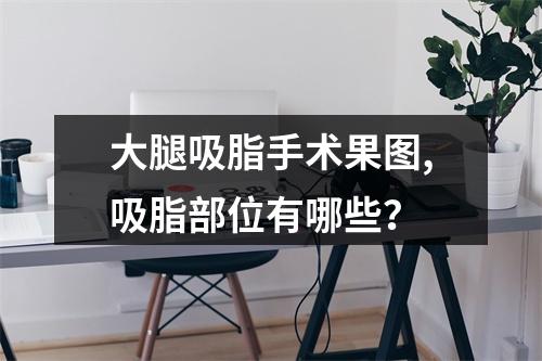 大腿吸脂手术果图,吸脂部位有哪些？