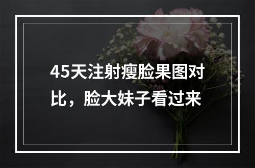 45天注射瘦脸果图对比，脸大妹子看过来