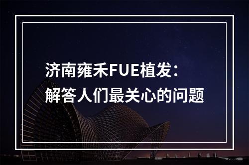 济南雍禾FUE植发：解答人们最关心的问题