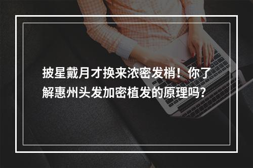 披星戴月才换来浓密发梢！你了解惠州头发加密植发的原理吗？