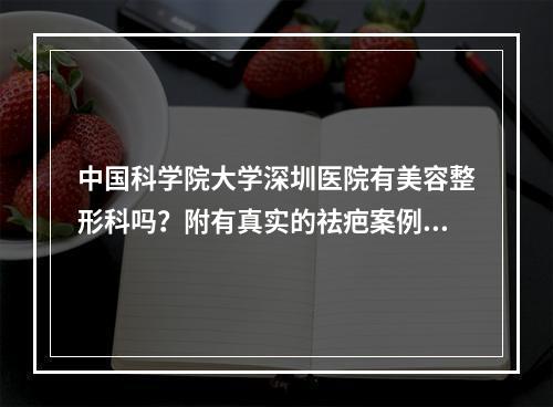 中国科学院大学深圳医院有美容整形科吗？附有真实的祛疤案例过程！