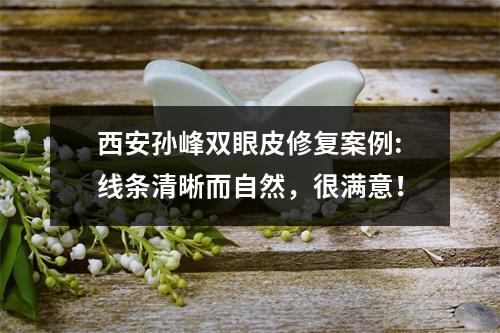 西安孙峰双眼皮修复案例:线条清晰而自然，很满意！