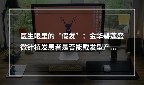 医生眼里的“假发”：金华碧莲盛微针植发患者是否能戴发型产品？