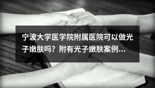 宁波大学医学院附属医院可以做光子嫩肤吗？附有光子嫩肤案例分享