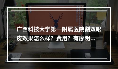 广西科技大学第一附属医院割双眼皮效果怎么样？费用？有廖明德、于海生坐诊！