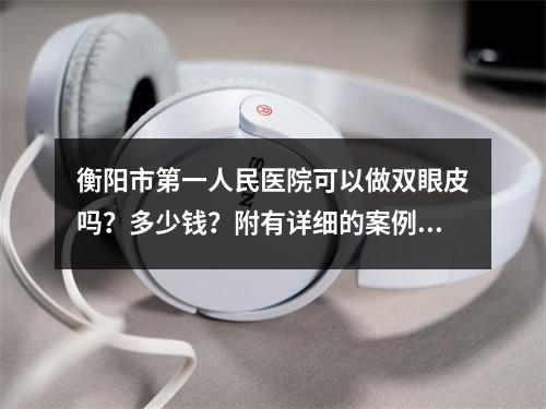 衡阳市第一人民医院可以做双眼皮吗？多少钱？附有详细的案例分享！