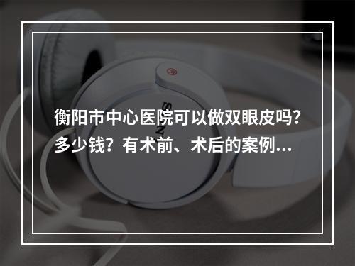 衡阳市中心医院可以做双眼皮吗？多少钱？有术前、术后的案例分享！