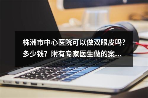 株洲市中心医院可以做双眼皮吗？多少钱？附有专家医生做的案例分享！