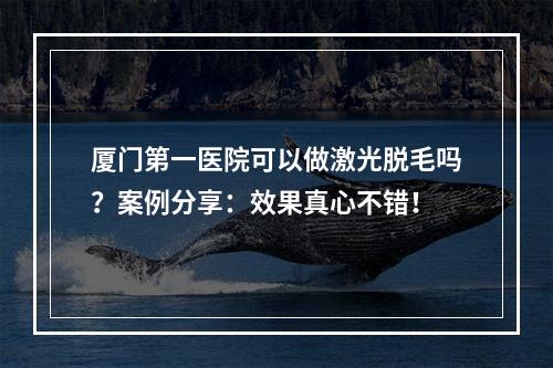 厦门第一医院可以做激光脱毛吗？案例分享：效果真心不错！