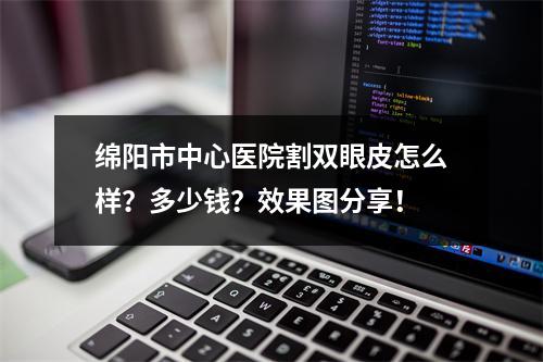 绵阳市中心医院割双眼皮怎么样？多少钱？效果图分享！