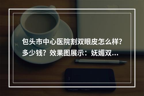 包头市中心医院割双眼皮怎么样？多少钱？效果图展示：妩媚双眼皮是真的香！