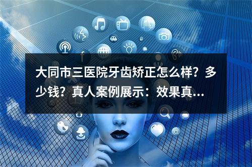 大同市三医院牙齿矫正怎么样？多少钱？真人案例展示：效果真心不错！