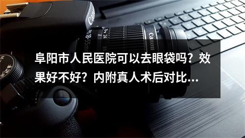 阜阳市人民医院可以去眼袋吗？效果好不好？内附真人术后对比图