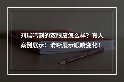 刘瑞鸣割的双眼皮怎么样？真人案例展示：清晰展示眼睛变化！