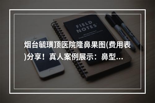 烟台毓璜顶医院隆鼻果图(费用表)分享！真人案例展示：鼻型漂亮、很满意！