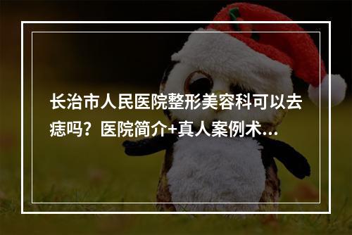 长治市人民医院整形美容科可以去痣吗？医院简介+真人案例术后恢复图！