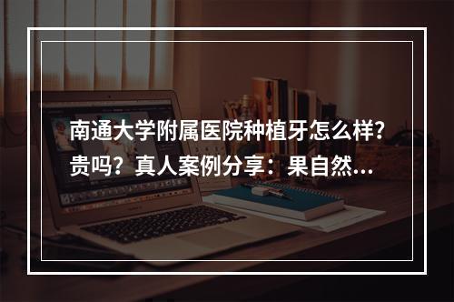 南通大学附属医院种植牙怎么样？贵吗？真人案例分享：果自然、价格合理！