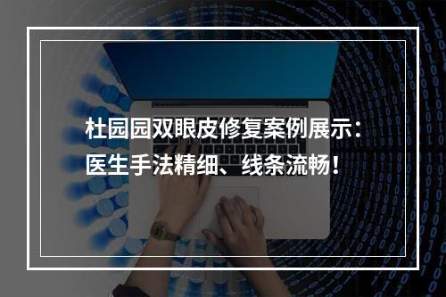 杜园园双眼皮修复案例展示：医生手法精细、线条流畅！