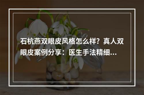 石杭燕双眼皮风格怎么样？真人双眼皮案例分享：医生手法精细、线条流畅！