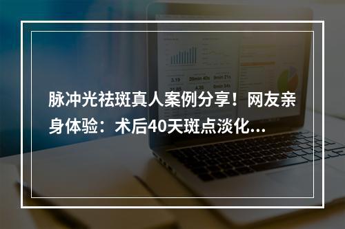 脉冲光祛斑真人案例分享！网友亲身体验：术后40天斑点淡化不少！