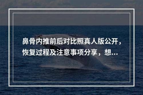 鼻骨内推前后对比照真人版公开，恢复过程及注意事项分享，想做的你赶紧看看~