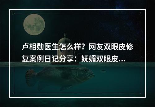 卢相勋医生怎么样？网友双眼皮修复案例日记分享：妩媚双眼皮自己都惊艳到！