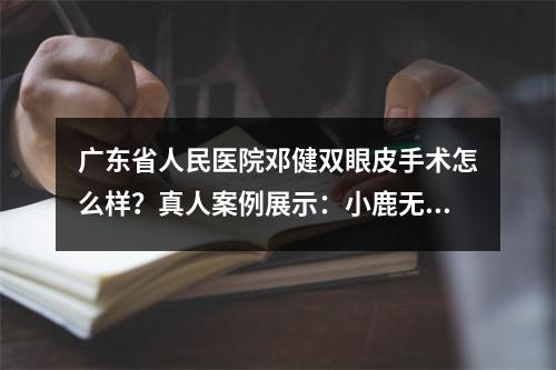 广东省人民医院邓健双眼皮手术怎么样？真人案例展示：小鹿无辜眼养成