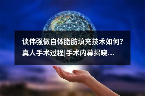 谈伟强做自体脂肪填充技术如何？真人手术过程|手术内幕揭晓|医生简介