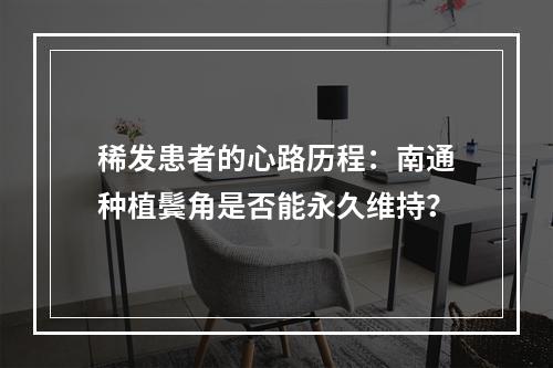 稀发患者的心路历程：南通种植鬓角是否能永久维持？