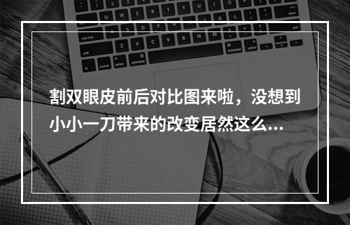 割双眼皮前后对比图来啦，没想到小小一刀带来的改变居然这么大！