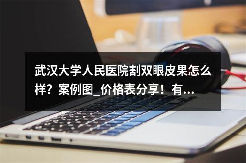 武汉大学人民医院割双眼皮果怎么样？案例图_价格表分享！有想法的姐妹们戳进来了解下吧