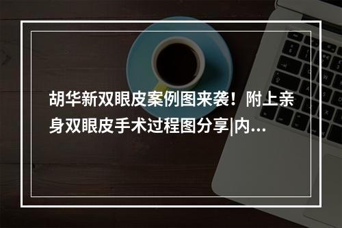 胡华新双眼皮案例图来袭！附上亲身双眼皮手术过程图分享|内幕揭晓