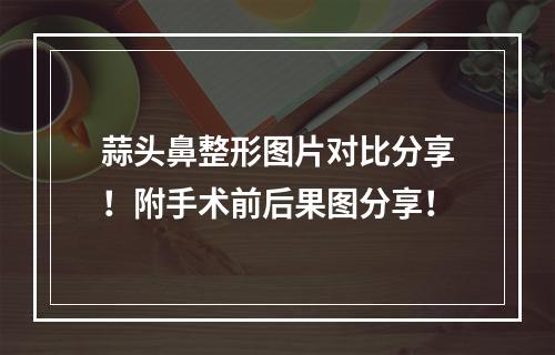 蒜头鼻整形图片对比分享！附手术前后果图分享！