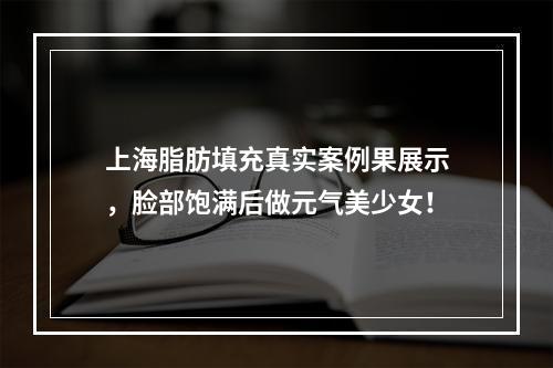 上海脂肪填充真实案例果展示，脸部饱满后做元气美少女！