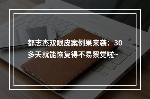 都志杰双眼皮案例果来袭：30多天就能恢复得不易察觉啦~