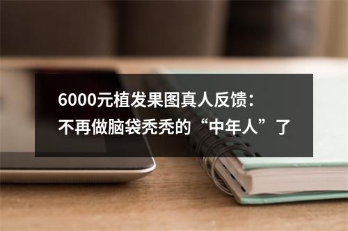 6000元植发果图真人反馈：不再做脑袋秃秃的“中年人”了