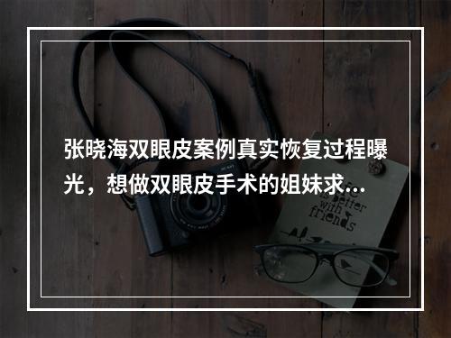 张晓海双眼皮案例真实恢复过程曝光，想做双眼皮手术的姐妹求评价