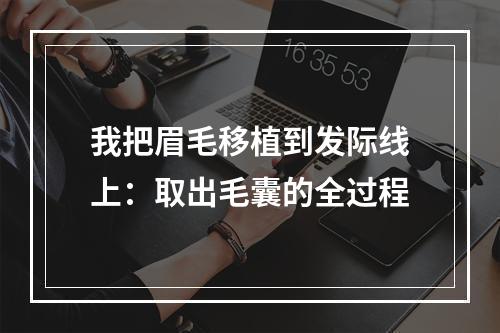 我把眉毛移植到发际线上：取出毛囊的全过程