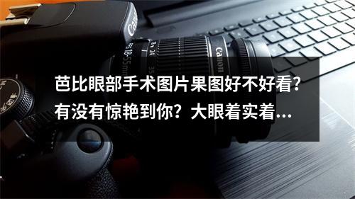 芭比眼部手术图片果图好不好看？有没有惊艳到你？大眼着实着迷!