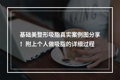 基础美整形吸脂真实案例图分享！附上个人做吸脂的详细过程