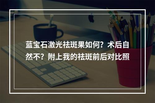 蓝宝石激光祛斑果如何？术后自然不？附上我的祛斑前后对比照